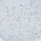 //inrorwxhrkinln5q-static.micyjz.com/cloud/liBpjKnjlkSRqilpljkoiq/3afded9991ae7646d5e78d579a3582d3-60-60.jpg