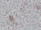 //inrorwxhrkinln5q-static.micyjz.com/cloud/liBpjKnjlkSRqippjkoriq/0411630f2fb1108d84d77439be5da60c-60-60.png