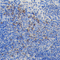 //inrorwxhrkinln5q-static.micyjz.com/cloud/ljBpjKnjlkSRqipppjplip/02cfe9db09a22574ef3f909a57c7d772-60-60.jpg