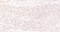 //inrorwxhrkinln5q-static.micyjz.com/cloud/lkBpjKnjlkSRqippijloiq/142a8554cfdd0d83bc153dc68b534e70-60-60.jpg