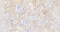 //inrorwxhrkinln5q-static.micyjz.com/cloud/llBpjKnjlkSRqiqpnkrqiq/1595467994855418734-6348-Legumain-dashushen-1-100_26-6x-60-60.jpg