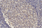 //inrorwxhrkinln5q-static.micyjz.com/cloud/lmBpjKnjlkSRqippqioniq/1596180910127060032-60-60.png