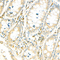 //inrorwxhrkinln5q-static.micyjz.com/cloud/lnBpjKnjlkSRqippmrroiq/7813a940022f4e94e88bb6dab23f465c-60-60.jpg