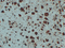 //inrorwxhrkinln5q-static.micyjz.com/cloud/lnBpjKnjlkSRqippokkkiq/5445011817aeb78ad8927db505ccd949-60-60.png