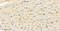 //inrorwxhrkinln5q-static.micyjz.com/cloud/lnBpjKnjlkSRqiqppojriq/1607129958239161221-60-60.jpg