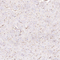 //inrorwxhrkinln5q-static.micyjz.com/cloud/loBpjKnjlkSRqikppprniq/6a02bdc5c49b2f39bb6f08a790cecb21-60-60.jpg