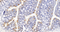 //inrorwxhrkinln5q-static.micyjz.com/cloud/loBpjKnjlkSRqiqplkmiiq/1595306627594067901-6267-ZNT1-xiaoshujiechang-1-650_23-4x-60-60.jpg