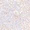 //inrorwxhrkinln5q-static.micyjz.com/cloud/lpBpjKnjlkSRqippljjrio/8d163553c14c1d1208d5bcc2de6e1477-60-60.jpg