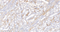 //inrorwxhrkinln5q-static.micyjz.com/cloud/lpBpjKnjlkSRqiqpmjkniq/1594969868346460849-H-shen-collagen-III-6158-1-1000_16-3x-60-60.jpg
