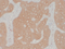 //inrorwxhrkinln5q-static.micyjz.com/cloud/lrBpjKnjlkSRqippikjliq/56030864a7e2813d8f98df6d2b1f0147-60-60.png