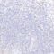 //inrorwxhrkinln5q-static.micyjz.com/cloud/lrBpjKnjlkSRqiqpppilip/dc5a4d6d5d1cd8da02a6a3543ca3963f-60-60.jpg